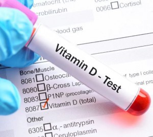 Анализ витамин Д